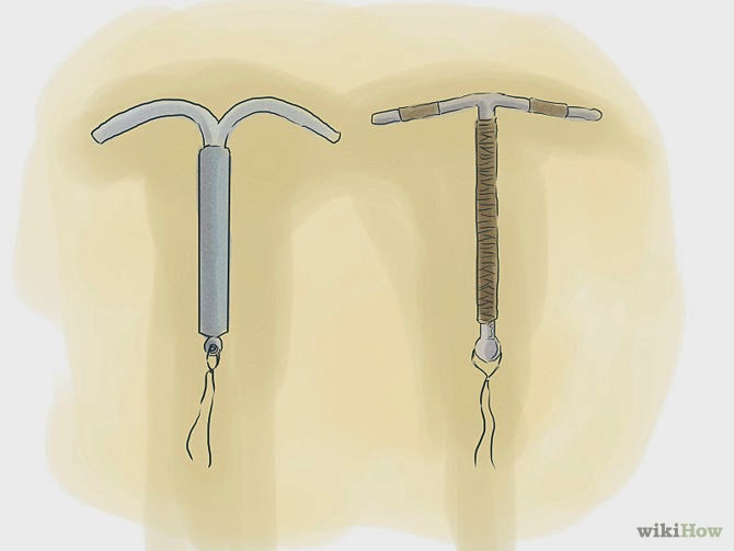 วิธีการป้องกันตั้งครรภ์อุปกรณ์มดลูก