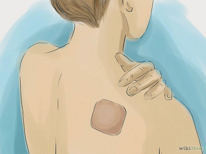 วิธีการป้องกันตั้งครรภ์แผ่นคุมกำเนิด