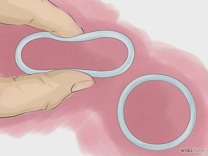 วิธีการป้องกันตั้งครรภ์แหวนคุมกำเนิด